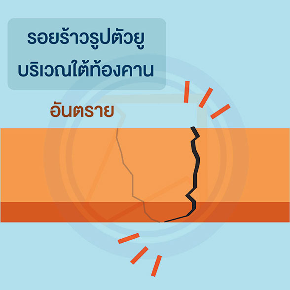อันตราย!! จาก ผนังร้าว : รอยร้าวที่มีผลกับโครงสร้าง