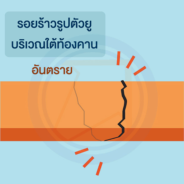 อันตราย จาก “ผนังบ้านร้าว”ตอน : รอยร้าวที่มีผลกระทบกับโครงสร้าง